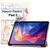 Чехол для планшета BeCover Smart Xiaomi Redmi Pad 2 11.0" Fairy (713653) Чехол для планшета BeCover Smart Xiaomi Redmi Pad 2 11.0" Fairy (713653)
