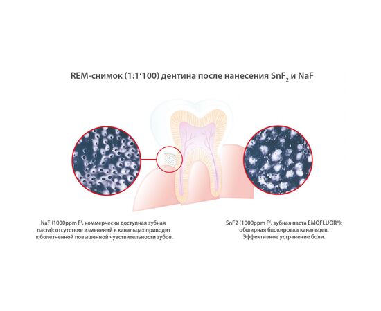 Зубная паста Dr. Wild Emofluor Daily Care со стабилизированным фторидом олова 75 мл (7611841701686), изображение 4