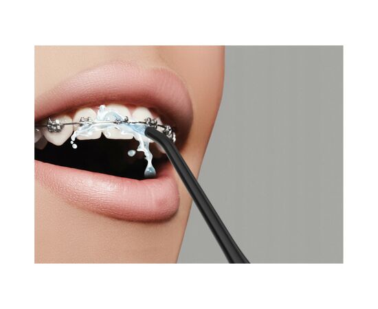 Ирригатор Evorei Boost 1 Gum Irrigator (5902479672489), изображение 8 Ирригатор Evorei Boost 1 Gum Irrigator (5902479672489), изображение 8