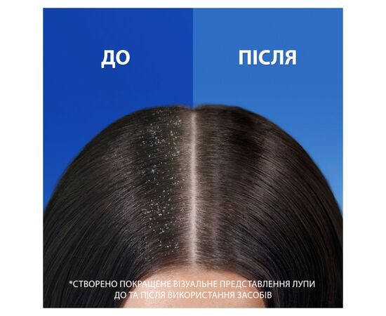 Шампунь Head & Shoulders 2 в 1 Против перхоти Свежесть ментола 330 мл (8700216304825), изображение 6 Шампунь Head & Shoulders 2 в 1 Против перхоти Свежесть ментола 330 мл (8700216304825), изображение 6