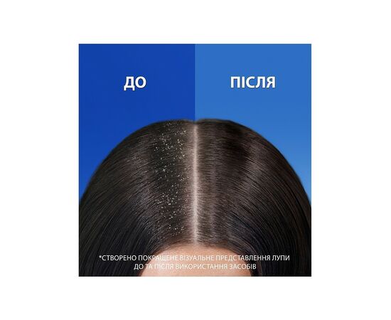 Шампунь Head & Shoulders 2 в 1 Против перхоти Гладкие и шелковистые 330 мл (8700216304856), изображение 3 Шампунь Head & Shoulders 2 в 1 Против перхоти Гладкие и шелковистые 330 мл (8700216304856), изображение 3