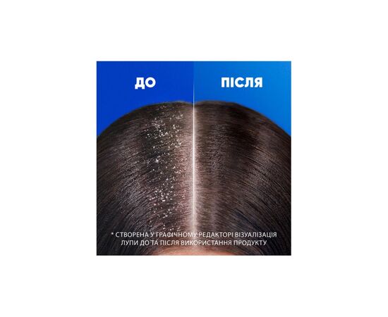 Шампунь Head & Shoulders Цитрусовая свежесть 400 мл (5011321336032), изображение 4 Шампунь Head & Shoulders Цитрусовая свежесть 400 мл (5011321336032), изображение 4