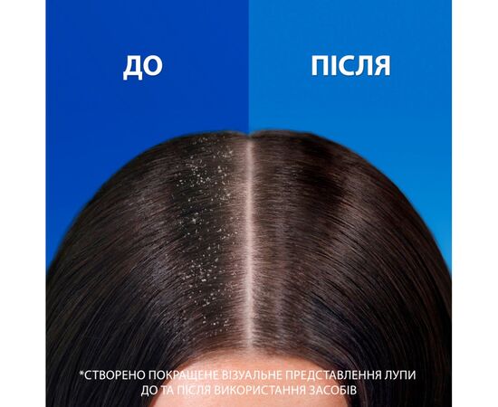 Шампунь Head & Shoulders Pro-Expert 7 Интенсивное спасение 250 мл (8700216156844), изображение 3 Шампунь Head & Shoulders Pro-Expert 7 Интенсивное спасение 250 мл (8700216156844), изображение 3