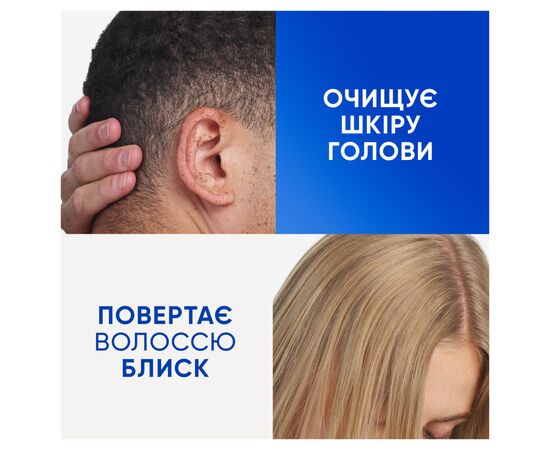 Шампунь Head & Shoulders Clarify & Shine Против перхоти Очищение и блеск 400 мл (8700216658461), изображение 6 Шампунь Head & Shoulders Clarify & Shine Против перхоти Очищение и блеск 400 мл (8700216658461), изображение 6