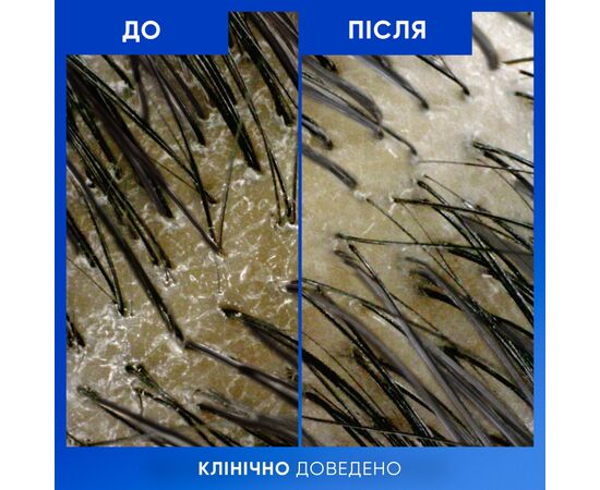 Шампунь Head & Shoulders Clarify & Shine Против перхоти Очищение и блеск 400 мл (8700216658461), изображение 7 Шампунь Head & Shoulders Clarify & Shine Против перхоти Очищение и блеск 400 мл (8700216658461), изображение 7