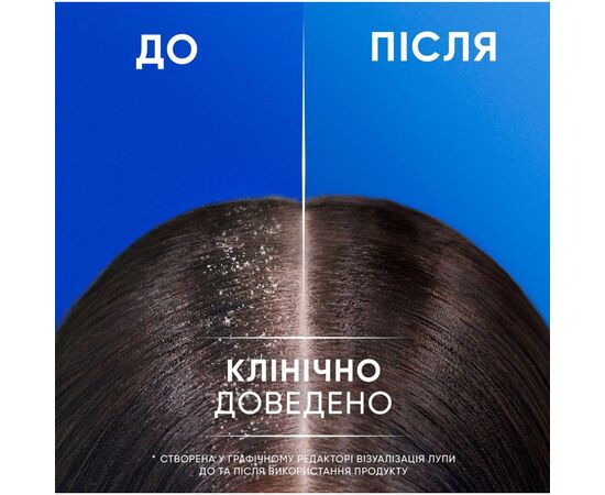 Шампунь Head & Shoulders 2 в 1 Против перхоти Яблочная свежесть 330 мл (8700216304689), изображение 6 Шампунь Head & Shoulders 2 в 1 Против перхоти Яблочная свежесть 330 мл (8700216304689), изображение 6