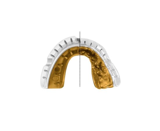 Капа Opro Gold Braces під брекети White/Gold (102506004) (Gold_Braces_Wh/Gold), изображение 9 Капа Opro Gold Braces під брекети White/Gold (102506004) (Gold_Braces_Wh/Gold), изображение 9