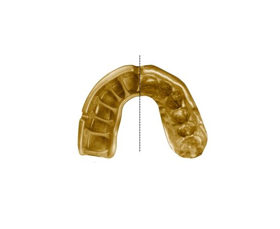 Капа Opro Gold Grillz Black/Gold (102504012) (Gold_Grillz_Bl/Gold), зображення 3 Капа Opro Gold Grillz Black/Gold (102504012) (Gold_Grillz_Bl/Gold), зображення 3