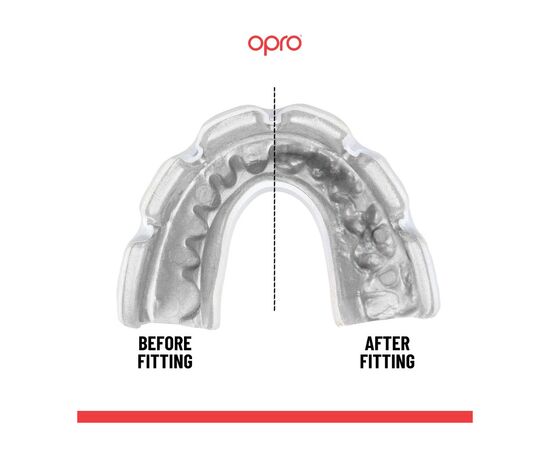 Капа Opro Instant Single Colour Braces Clear (102522007) (Instant_Braces_Clear), изображение 4 Капа Opro Instant Single Colour Braces Clear (102522007) (Instant_Braces_Clear), изображение 4