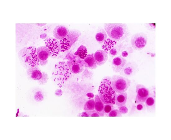 Набор микропрепаратов Bresser Histology 30 шт (5985000) (931505), изображение 2 Набор микропрепаратов Bresser Histology 30 шт (5985000) (931505), изображение 2