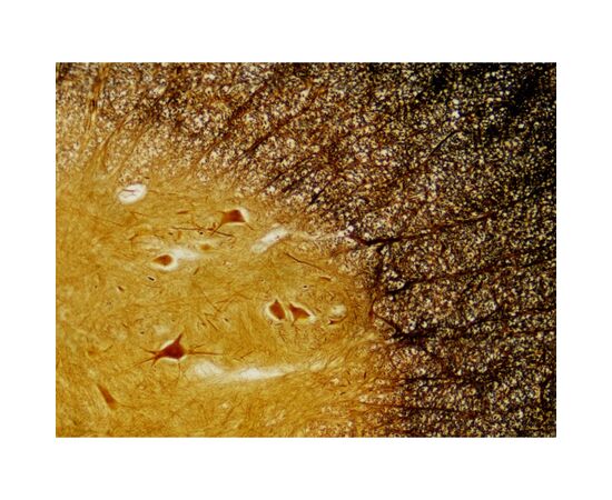 Набор микропрепаратов Bresser Histology 30 шт (5985000) (931505), изображение 3 Набор микропрепаратов Bresser Histology 30 шт (5985000) (931505), изображение 3