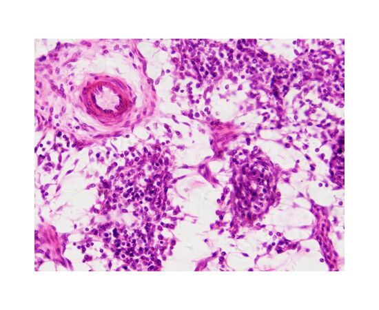 Набор микропрепаратов Bresser Histology 30 шт (5985000) (931505), изображение 5 Набор микропрепаратов Bresser Histology 30 шт (5985000) (931505), изображение 5