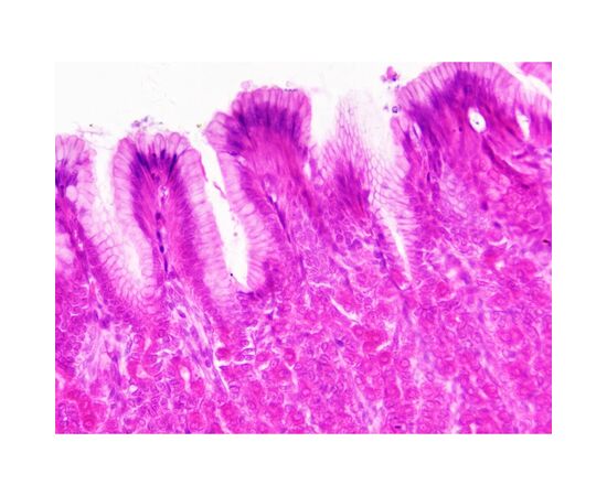 Набор микропрепаратов Bresser Histology 30 шт (5985000) (931505), изображение 6 Набор микропрепаратов Bresser Histology 30 шт (5985000) (931505), изображение 6