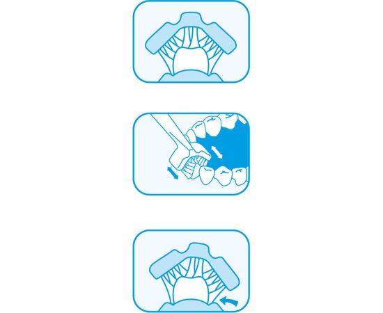 Детская зубная щетка Dr. Barman's Superbrush (Dentaco AG), 9603210000, тристороння (від 0-6 років), салатова (8.121/5), изображение 2 Детская зубная щетка Dr. Barman's Superbrush (Dentaco AG), 9603210000, тристороння (від 0-6 років), салатова (8.121/5), изображение 2