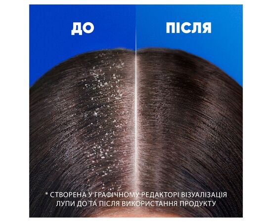 Шампунь Head & Shoulders Основний догляд 400 мл (5011321336049), зображення 5