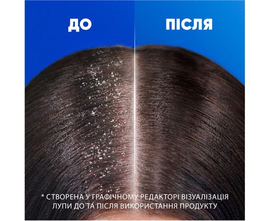 Шампунь Head & Shoulders 2 в 1 Проти лупи Основний догляд 625 мл (8700216304948), зображення 6