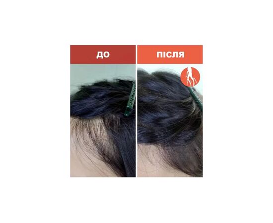 Шампунь SH-RD Red-Ginseng Hair-Activating Shampoo 200 мл (652418100317), зображення 6